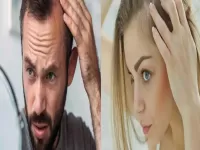 home remedies for hairfall in hindi 